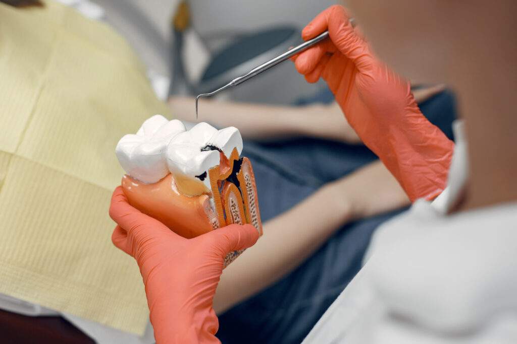 Endodoncia: salvar tu diente antes de perderlo