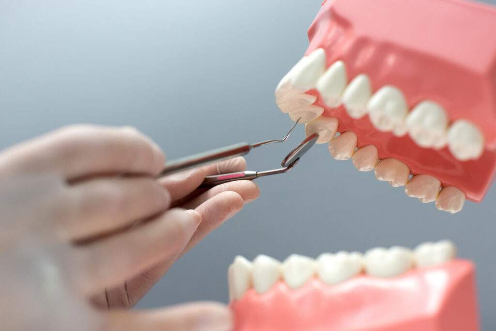 Periodoncia: la clave para mantener dientes sanos toda la vida